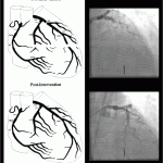 Dad-Heart-Cath-20090613